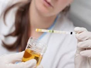 urine_test