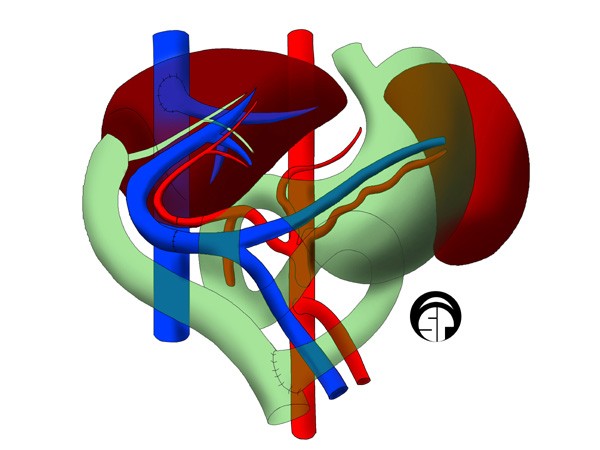 LiverTransplant_oct23