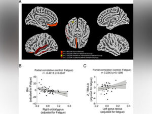 pnas.2200960119fig012022081122390020220811230646